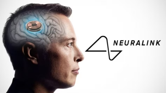 Ezrek állnak sorba a Neuralink agy-chip implantátumáért