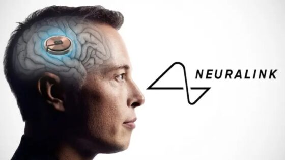 Elon Musk és a Neuralink második felhasználója már agyával videojátékozik